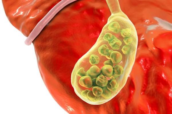 Hysterectomy Procedure