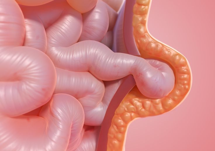 Piles & Fissures Treatment